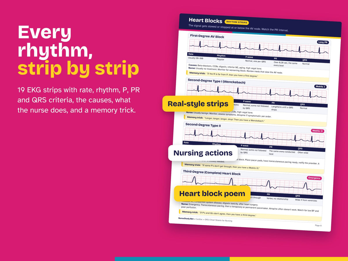EKG rhythm strips with criteria